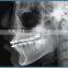 Digital Dental Panoramic Radiology Machine
