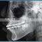 Digital Dental Panoramic X-ray Equipment for Clinic