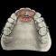 Orthodontic-Appliance  China Dental Laboratory - Outsourcing Dental Lab