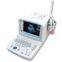 Portable Convex Ultrasound Scanner--CE certified