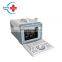 Cheap price full digital Portable ultrasound machine scanner/cheaper ultrasound machine