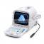 Beautiful compact diagnostic ultrasound probe / mini ultrasound machine / Portable ultrasound scanner