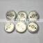 Control valve orifice engine assembly diesel 36 36# for denso fuel injector 095000-6793 095000-6791 095000-6790 Valve plate