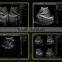 Cheapest Portable Black & White Ultrasound Machine- BPU14