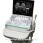 SS-7 Laptop Ultrasound Scanner(ultrasonic,black white,Imaging Sy