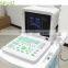 Factory Price Mini Laptop NEW Full Digital Portable Ultrasound Machine/Ultrasonic Scanner/Echo machine- BPU02