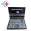 HC-A007 Factory Direct Medical Laptop portable Ultrasound scanner system ultrasound machine