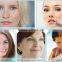 FDA Approved Laser Equipment Portable CO2 Fractional 0.1-2.6mm Vertical For Wrinkle Removal Skin Resurfacing CE Remove Tiny Wrinkle