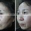 Three cartridges anti-aging HIFU facial therapy SMAS layer skin tightening pores shrinking HIFU device