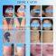 Tattoo removal best Q-switch ND YAG Laser rejuvi tattoo removal / tattoo removal laser equipment