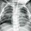radiographic x ray digital radiography equipment medical x ray equipment digital xray film                        
                                                Quality Choice