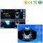 MABS03 medical equipment LCD touch screen cheap portable ultrasound bladder scanner with 3D mechanical scan probe