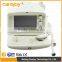 Factory price of 10 inch display white and black ultrasound machine for pregnancy