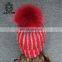 2017 New Trendy Winter Women Handmade Pompoms Cap Bobble Beanies Fur PomPom Hat