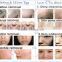 beauty machine tattoo/hair removal beauty salon/spa OD-IRL10 IPL RF E light nd yag laser price