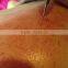 30 MHZ spider vein vascular removal device/high frequency vascular removal device