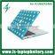 Fashion Wave Point Waterproof PC Case Cover for Macbook Air/Pro Retina 11"13"15" Frosted Hard Shell Case for Macbook Cover