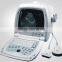Top quality factory price portable ultra sound machine for sale