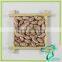 Pinto Bean Long Shape Or Round Shape Lskb
