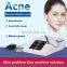 2019 Hot sale great effect portable acne removal machine for sale
