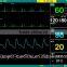 FDA multi-parameter patient monitor with veterinary monitoring available