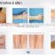 808nm diode laser hair removal machine from direct factory with CE approved