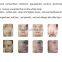 ipl shr hair removal machine SHR vertical ipl hair removal system
