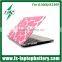 Hottest lovely pink shell case cover for Macbook Air 11/13" plastic protective case cover for Macbook Air/Pro 11" 13" 15"