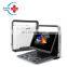 Professional laptop Ultrasound doppler/Used ultrasound machine laptop/Sonoscape e3