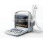 ultrasound scanner portable 2D 3D 4D doppler ultrasound price