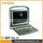 China cheap price USB portable laptop color doppler ultrasound scanner for pregnancy scanner ultrasound