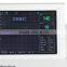 Hot Sale Model 8.4-inch screen color LCD display, Portable Fetal Monitor for single twins optional with printer-Shelly