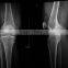 imaging x ray film for machine film x ray film processor wet film