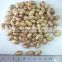 Round Shape light speckled kidney beans Crop 2015 ,Factory