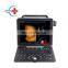 HC-A012F Ultrasound Scanner The Most Economical Portable Color Doppler Ultrasound Scanner color doppler ultrasound machine