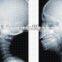 2015 medical film Dry Thermal x-ray Film agfa x-ray film 14x17 dt2b