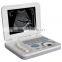 vet ultrasound with10.8" LED display 3D cheap professional animals use portable ultrasound 3018VL