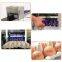 High Precision Egg Coding Printing Machine Egg Printing Machine