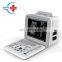 HC-A002 China original cheap LED Full Digital Portable Ultrasound Scanner