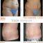 High Focused Ultrasonic High Intensity Focused Ultrasound High Frequency Facial Device HIFU Weight Loss Body Slimming Machine Painless