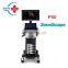 Excellent quality Ultrasound color doppler machine /Sonoscape ultrasound p50 /Color doppler ultrasound