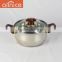 Wholesale stainless steel kitchen queen cookware set with glass lid and bakelite handle/knob
