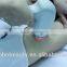 Professional 808nm qcw diode laser hair removal machine for sale