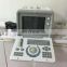 factory price china portable pregnancy diagnosis black and white  ultrasound scanner  machine