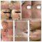 men hair removal mini machine E-light ipl dark spot remover from beijing factory price