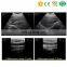 Working on Iphone Ipad Android phone/pad Medical Ultrasonic Scan Equipment Portable Wireless Ultrasound Probe