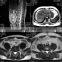 High Quality MY-D054 Medical Equipment MRI Scan System Magnetic Resonance Imaging MRI Scanner/Machine with Competitive price