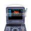 Hot selling 12 inch color ultrasound doppler machine for clinic and home use