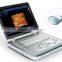 MCB-SS-10Plus Popular Laptop 4D B/W Ultrasound Machine