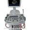 SS-600 Trolley Ultrasound Scanner